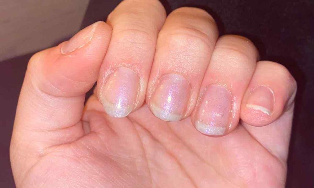 Fingernail of Index Finger