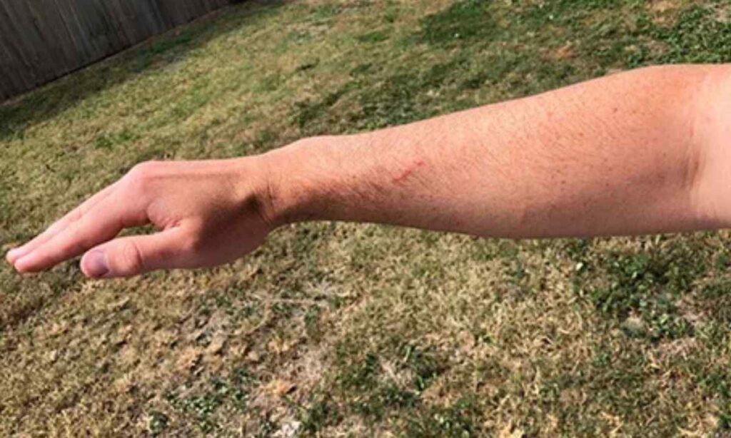 Forearm Length (Elbow to Fingertips)